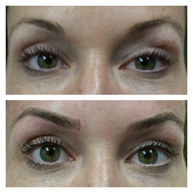 Eyebrow MicroBlading RSVP Med Spa Kansas City's Top Medical Spa Featuring The Finest Laser