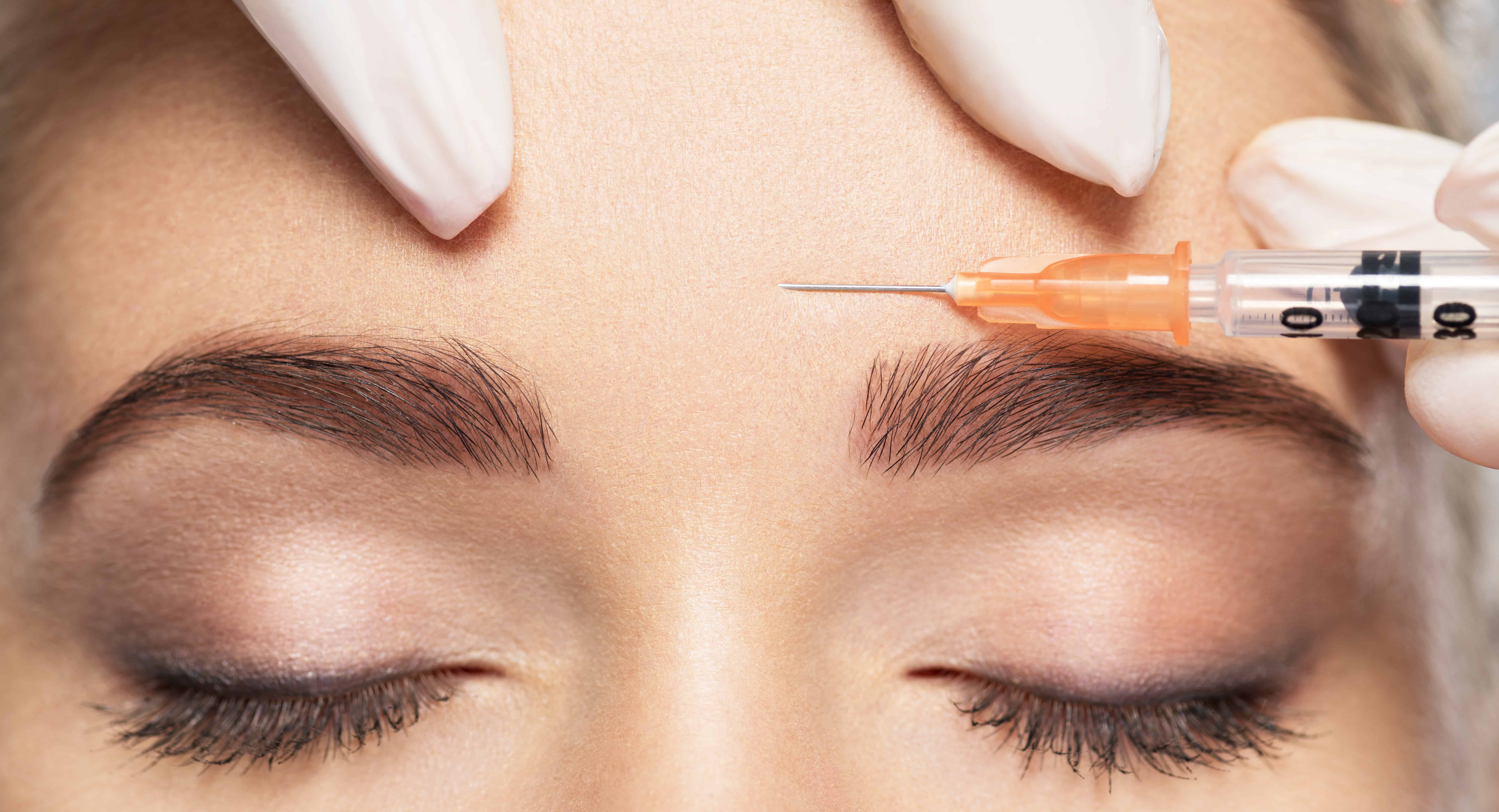 6 Things You Should Know About Botox